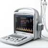 ML-5018 Portable Digital Ultrasound Scanner
