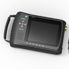 Laptop Ultrasound Scanner