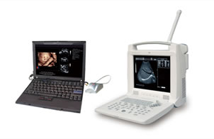 ML-3018I 3D Ultrasound Image Workstation