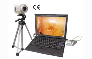 ML-9800 Digital Portable Colposcope