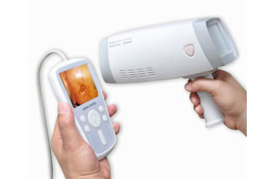 ML-9800B Handheld Video Colposcope